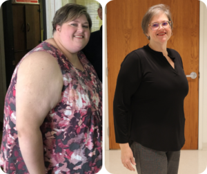 Heather Smith before and after losing 200lbs with the help of Fisher-Titus Diabetes Education.
